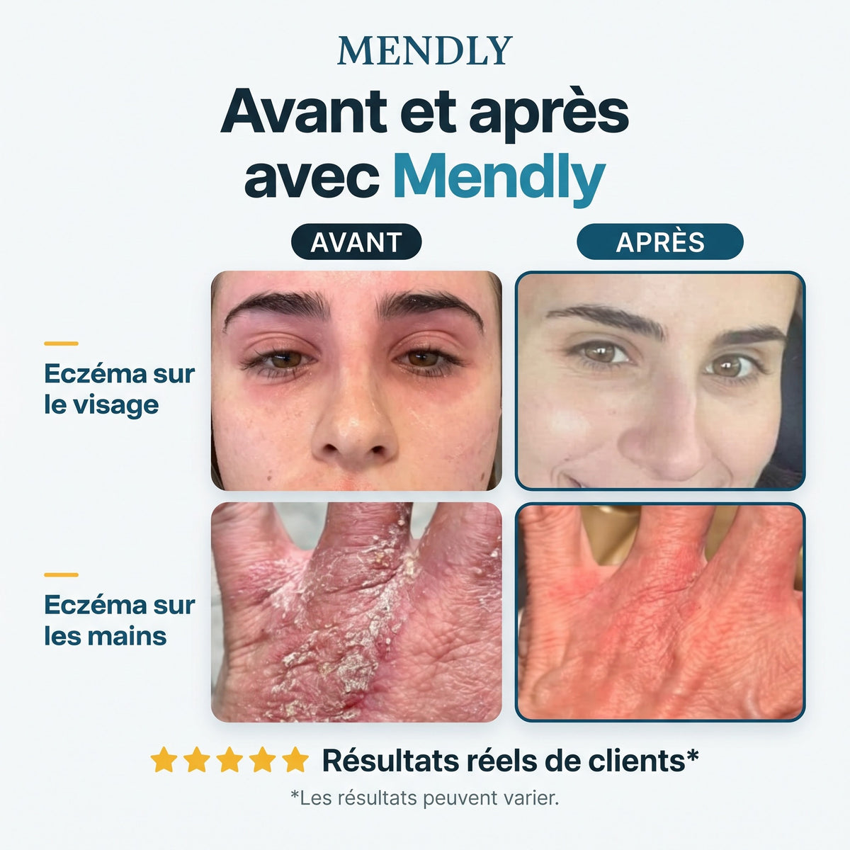 Avant et après avec Mendly