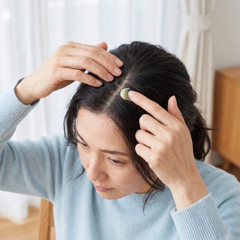 Psoriasis du cuir chevelu